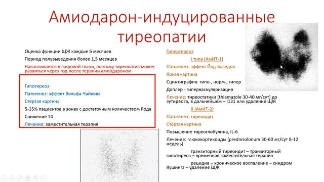 Амиодарон-индуцированные тиреопатии.