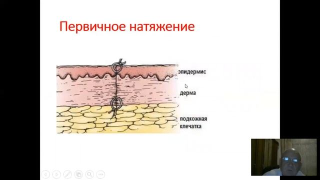 РАНЫ И РАНЕВОЙ ПРОЦЕСС смотреть онлайн