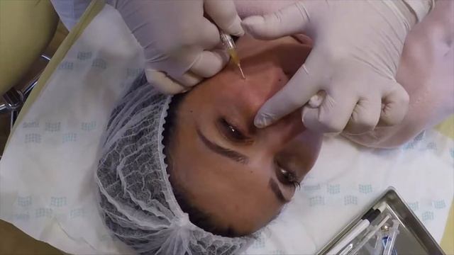 27. Векторный лифтинг, естественная подтяжка контура лица смотреть онлайн