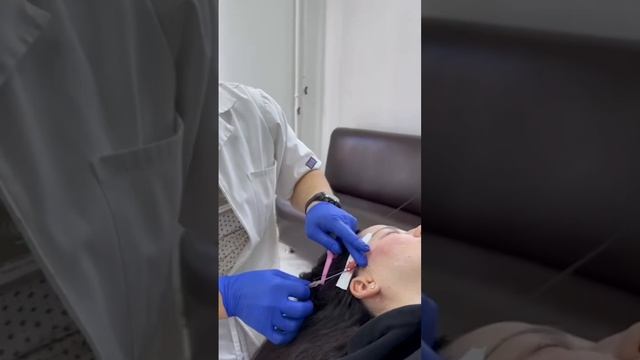 Нити коги(нитевой лифтинг) подтяжка лица нитями