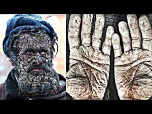 Этот Мужчина Не Мылся 60 Лет / Люди с Шокирующими Пристрастиями