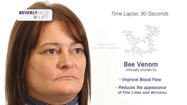 Beverly Hills V-Lift Bee Venom Instant Facelift - 30 смотреть онлайн