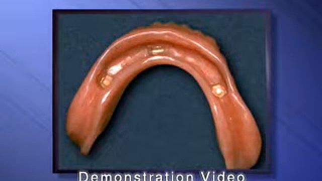 ПРИ ПОЛНОМ ОТСУТСТВИИ ЗУБОВ БРЯНЦЕВ смотреть онлайн