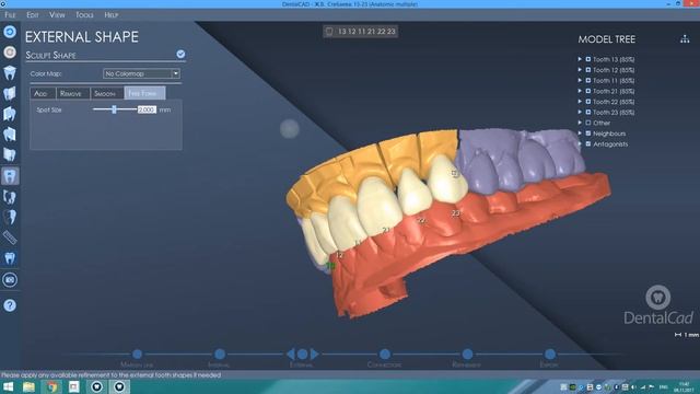моделирование временного мостовилного зубного протеза.