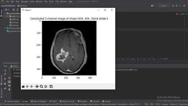 Stride effect Gaussian filter | Code implementation | Biomedical Image Processing смотреть онлайн