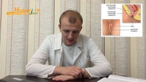 Анальная трещина. Какие симптомы и как лечить?