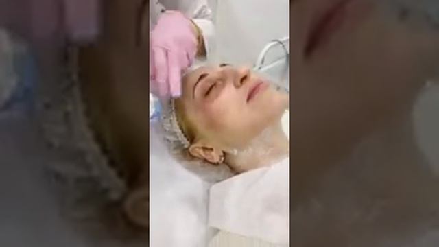 Микроигольчатый RF-лифтинг смотреть онлайн