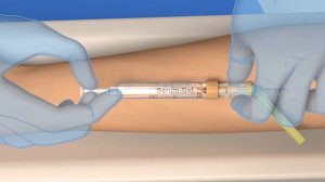 Blood collection: Vacuum with the S-Monovette® (ISO colour code) and Safety-Needle