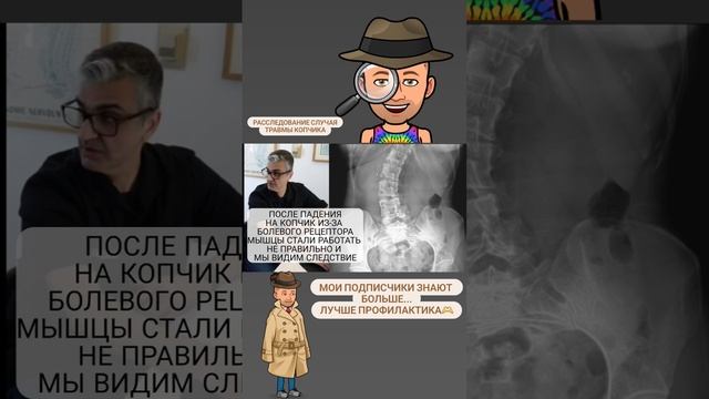 Травма копчика привела к сколиоз 40 градусов. #квантоваякоррекция #мастерхруст#pdtr #суджок #сколио смотреть онлайн