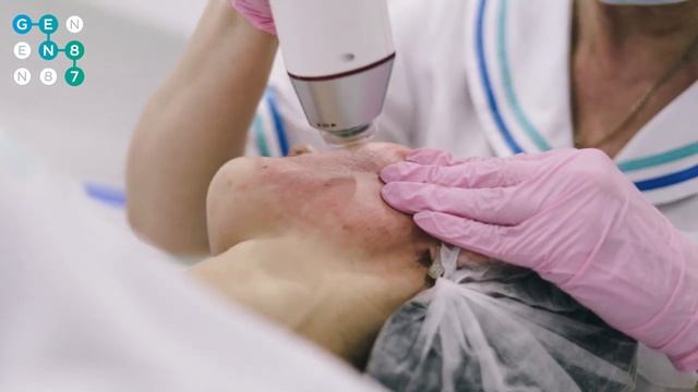 МИКРОИГОЛЬЧАТЫЙ ФРАКЦИОННЫЙ RF-ЛИФТИНГ INFINI Сеть клиник косметологии GEN87 смотреть онлайн