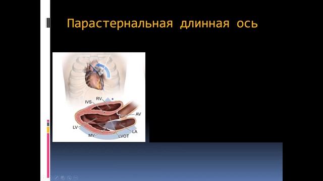 Месяц Н.С. "Эхокардиография. Режимы исследования. Доплерография" (Часть 1) 11.10.2023 смотреть онлайн