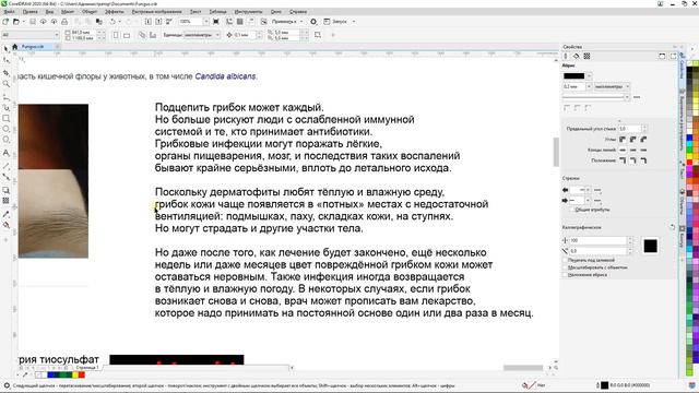 Грибковые проблемы Красители и Антикрасители[1080p] смотреть онлайн