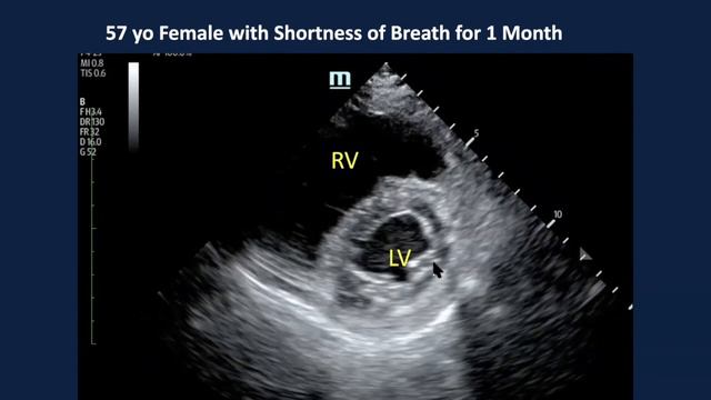 An Ultrasound Revolution: The Impact on Emergency Care смотреть онлайн