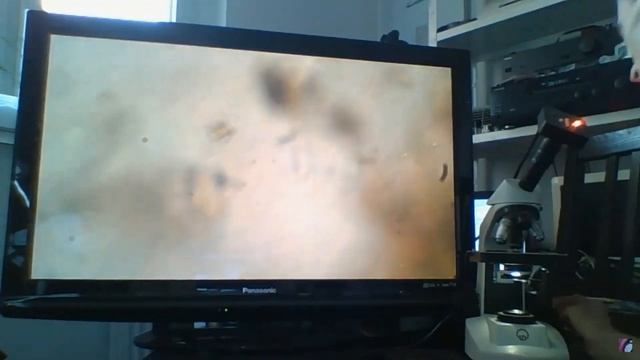 Тест под микроскопом: соль против грибка кандиды смотреть онлайн