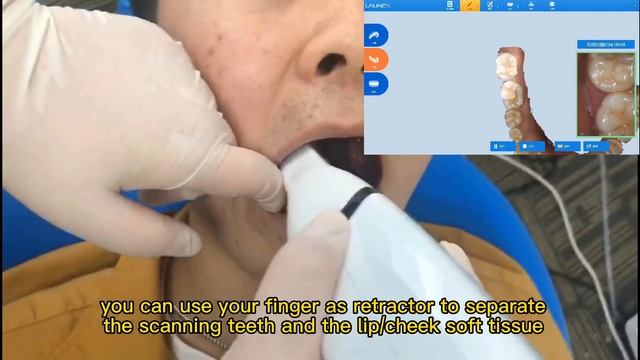 Launca training #8 Introducing how to avoid scanning unrelated soft tissues смотреть онлайн