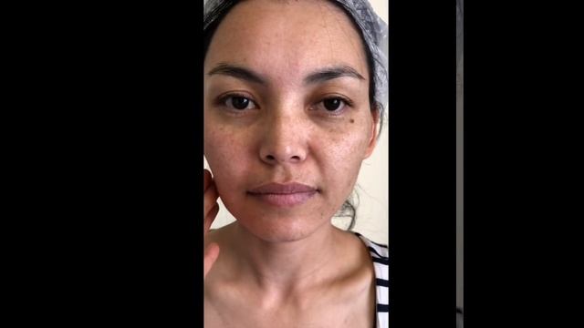 Гипертонус мышц смотреть онлайн