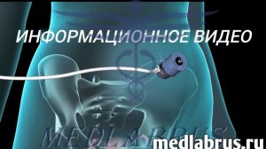 Перевязка маточных труб: метод стерилизации для предотвращения беременности