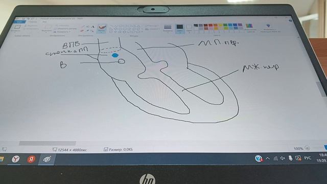 Проводящая система сердца. Анатомия в рисунках