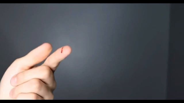 Топ 3 случая когда спиннер принёс вред!(Blood 18+) смотреть онлайн