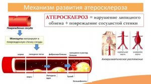 3.3. Атеросклероз