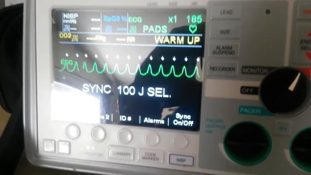 Cardioversion from zoll E-series monitor смотреть онлайн