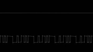 Bonus - Zippy the Porcupine (Atari 2600) [Oscilloscope]