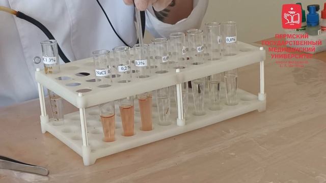 The osmotic fragility test. Determination of osmotic resistance of erythrocytes смотреть онлайн
