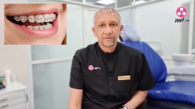 Как выбрать брекет-систему. Обзор. смотреть онлайн