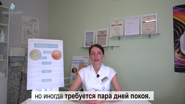 Стержневая мозоль. Удаление стержневой мозоли. смотреть онлайн