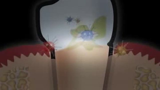 der richtige Einsatz der Munddusche смотреть онлайн