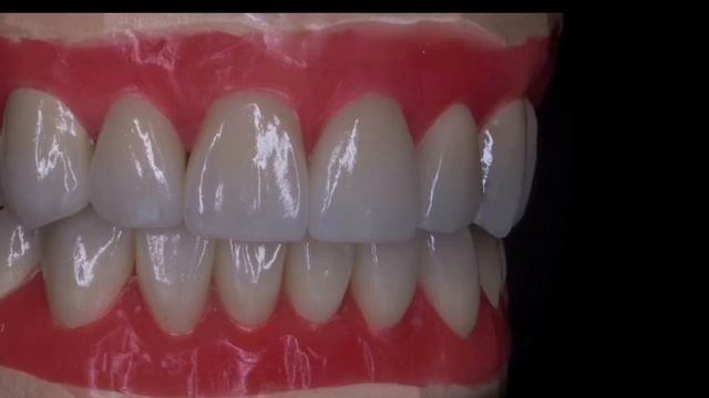 Стоматология фрязино , Сурайкин Илья , виниры , керамические коронки , керамические кладки , зуб , смотреть онлайн
