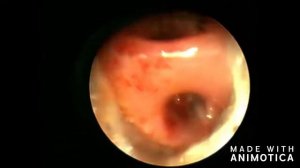 Учебная бронхоскопия