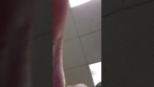 Prince Albert Reaction
