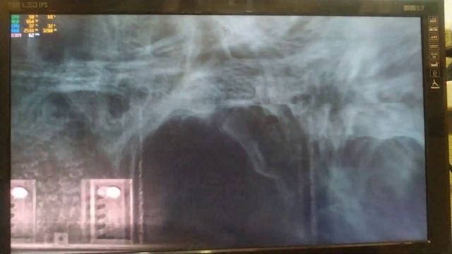 batman arkham asylum на слабом пк: amd athlon x4 640 8 озу gts 450 1gb смотреть онлайн