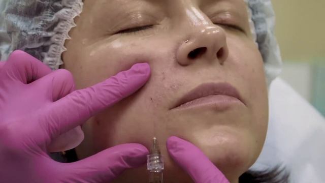 DELIGHT Classic - носослезные борозды смотреть онлайн