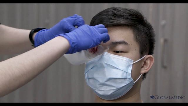 Eye Injury Травма глаза смотреть онлайн