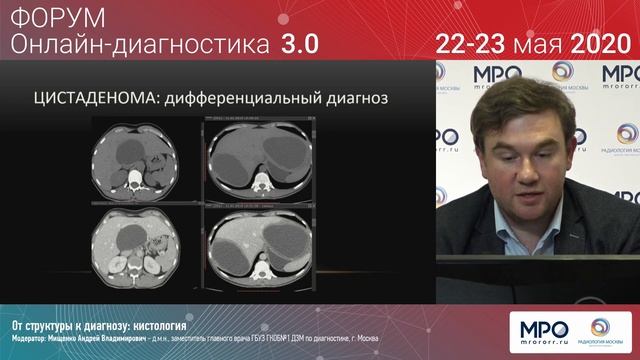«От структуры к диагнозу: кистология» , кистозные образования печени - Кондратьев Евгений Валерьеви смотреть онлайн