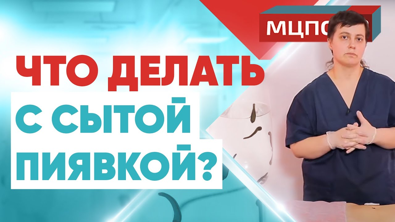 Что делать с сытой пиявкой? Курсы гирудотерапии. Обучение как ставить пиявки. Гирудотерапия смотреть онлайн