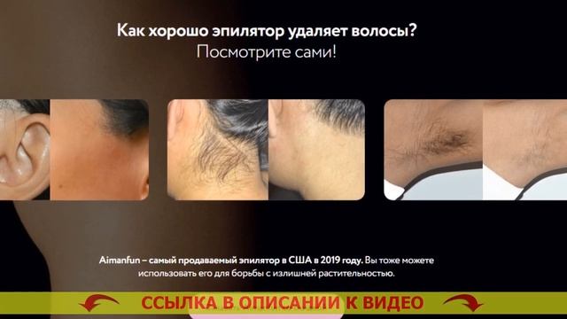 Какой эпилятор лучше купить фото или лазерный смотреть онлайн