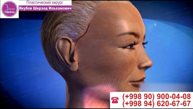 Подтяжка лица в Ташкенте Smas Lifting Пластический хирург Якубов Шерзод