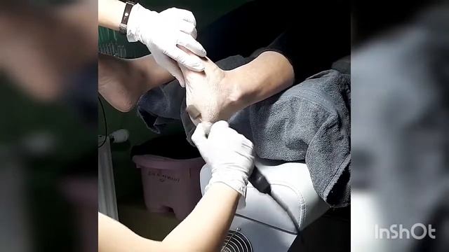 Сухая ,с трещинами кожа ног.Советы,как устранить сухость. Аппаратный педикюр. смотреть онлайн