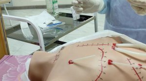 Обработка чистой раны