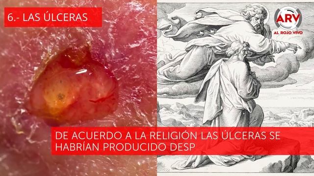 Las 10 plagas de Moisés pudieron ser reales y tienen explicación científica | Telemundo смотреть онлайн