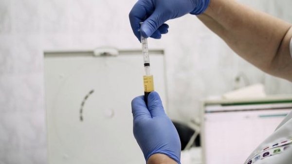 Концентрационная способность Cortexil PRP