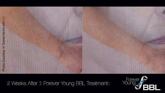 Beautiful Orlando BBL Forever Young смотреть онлайн