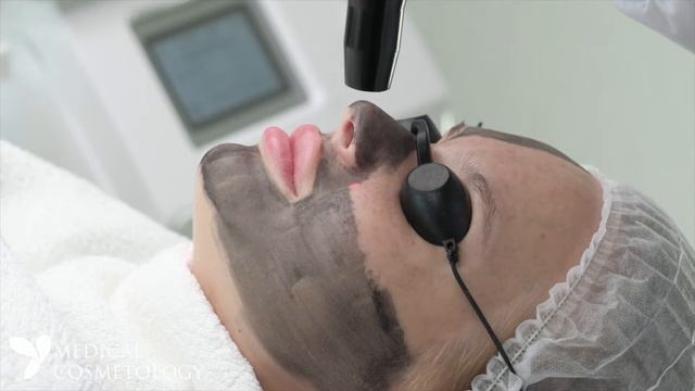 Лазерный карбоновый пилинг смотреть онлайн