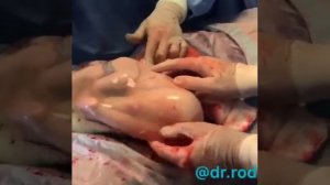 Мальчик родился  в рубашке😊