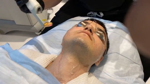 PART 2: CUTERA EXCEL V FOR FACIAL REDNESS, ACNE, AND TO IMPROVE SCAR PIGMENTATION | DR. JASON EMER смотреть онлайн