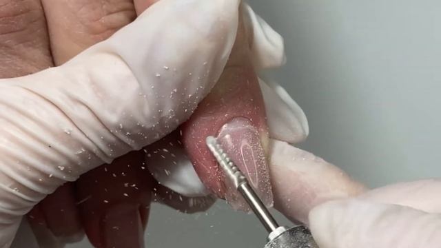 Верхние формы / укрепление торцов / срочная коррекция