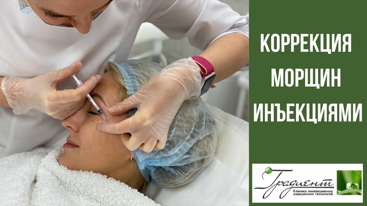 Инъекции ОТ МОРЩИН. Диспорт. смотреть онлайн